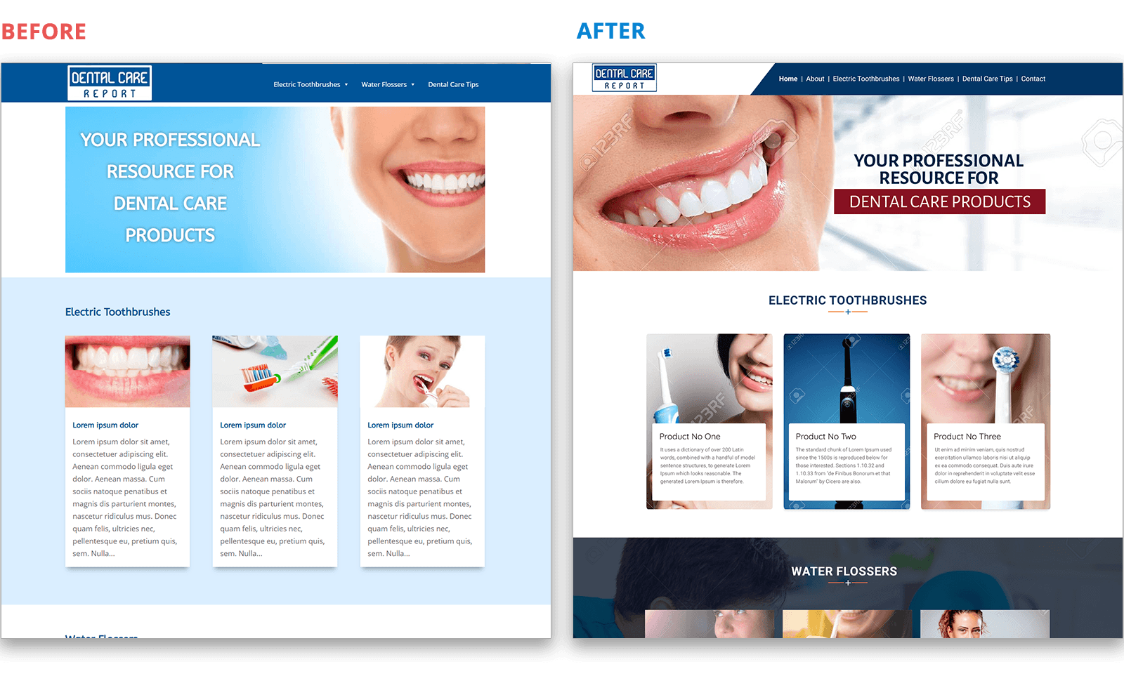 dental-care before after